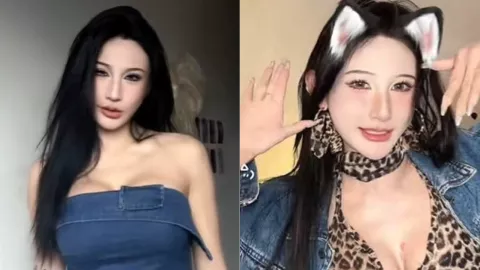 小张