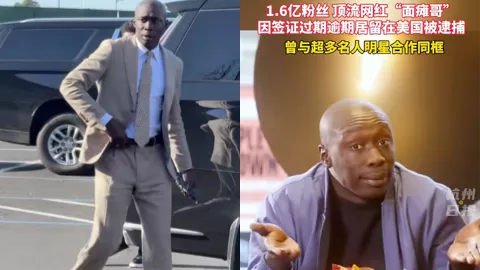 面瘫哥