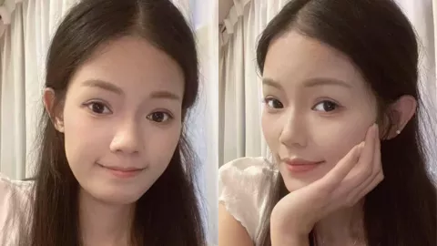 胡丽