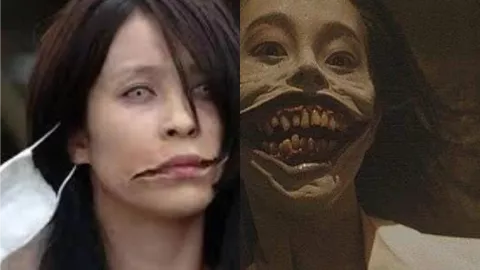 裂口女
