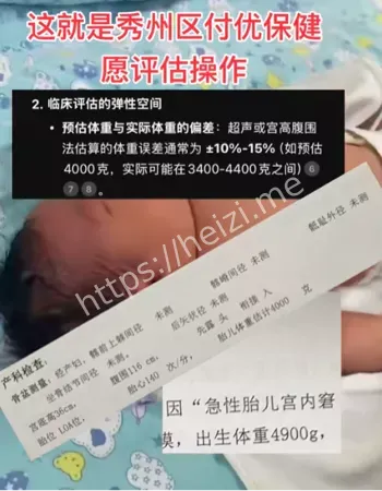 婴儿残疾