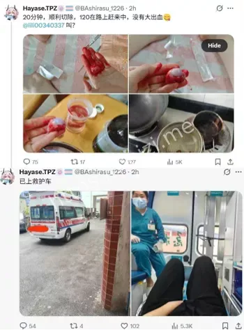 早濑TPZ