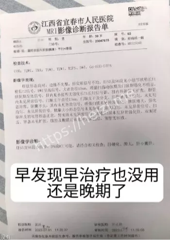 生命无常