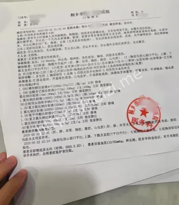 隆胸假体