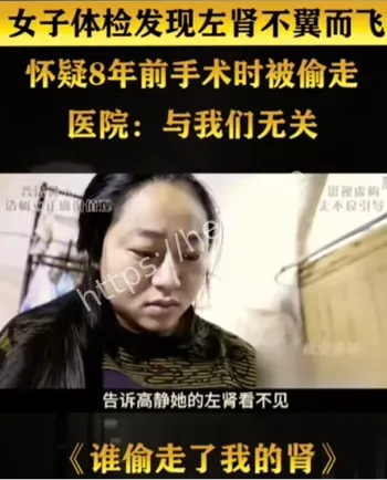 脾切除手术