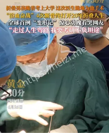 先天性肌肉病