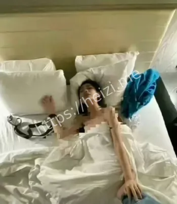 感染梅毒