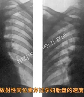 泯灭人性