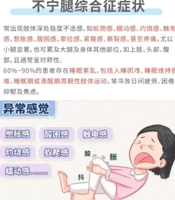 不宁腿综合征