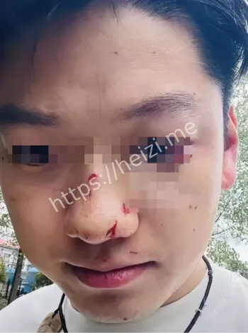 小车穿透护栏