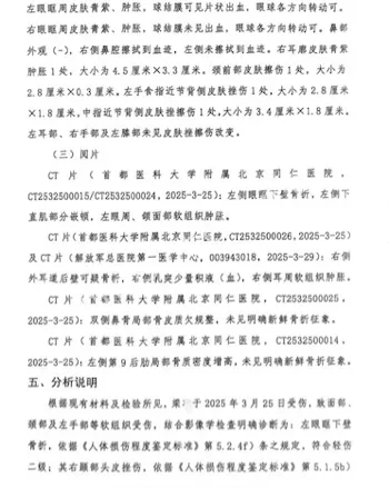 网友头部骨折
