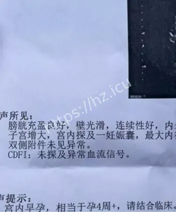 李沁雷军开房堕胎补偿