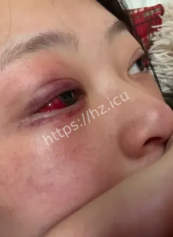 千万大V家暴小雪