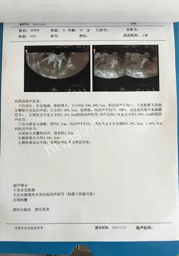 编辑分发参考