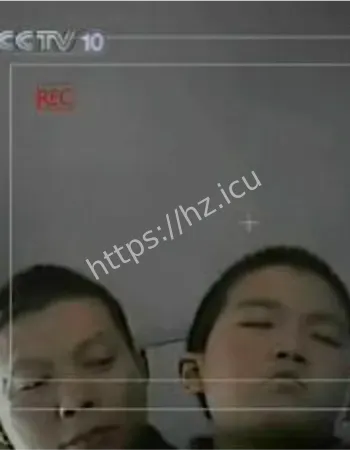 癔症性附体状态