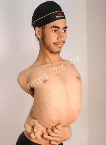 橡皮男孩火了