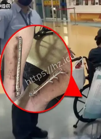 受害者亲述逃亡过程