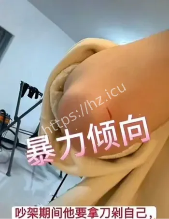 苏航感染HPV事件