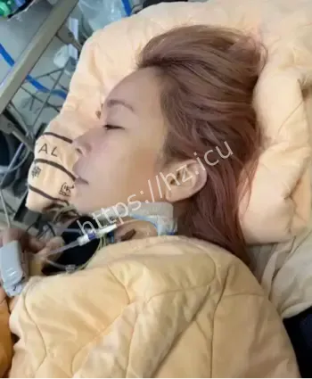温岚ICU抢救经历