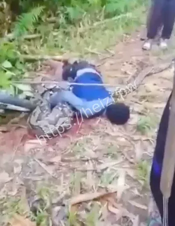 腹部隆起