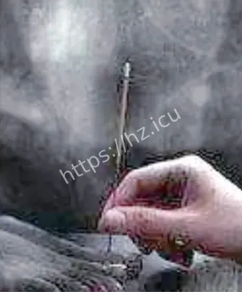 符水驱邪存在健康隐患